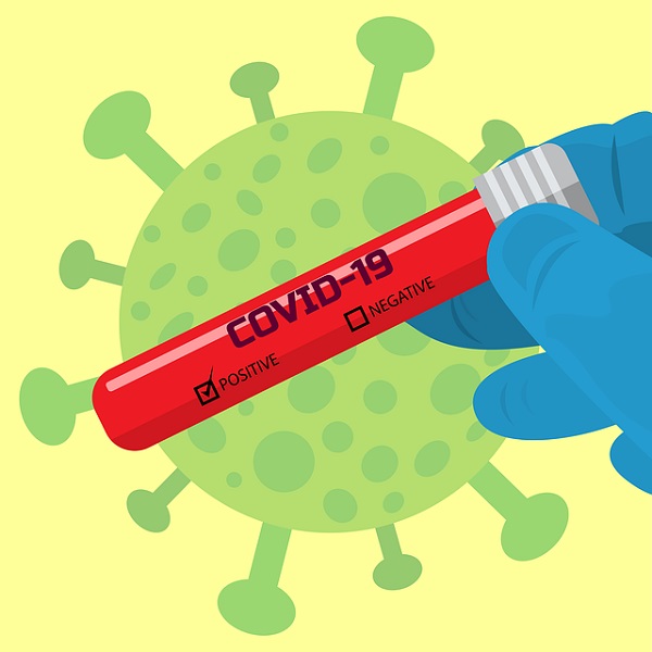Експрес-тест для визначення антигену SARS-CoV-2 додано до Номенклатури лікарських засобів та медичних виробів