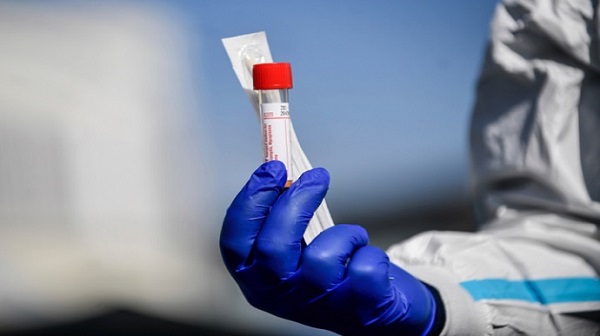 Щонайменше 40% українців мають антитіла до коронавірусу, — ЦГЗ