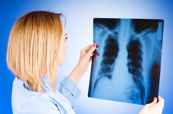 Минздрав утвердил новые стандарты лечения туберкулеза