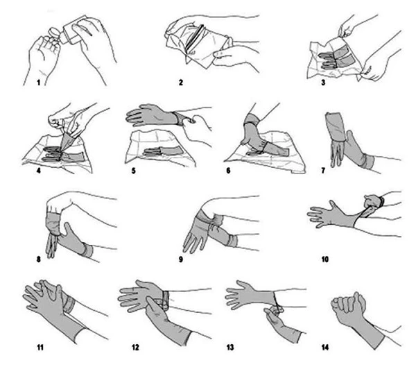 Как правильно одевать фото Как правильно надевать и снимать медицинские перчатки - стерильные, нестерильные