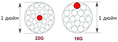 Периферические венозные катетеры: постановка и уход за местом введения Периферические венозные катетеры: постановка и уход за местом введения