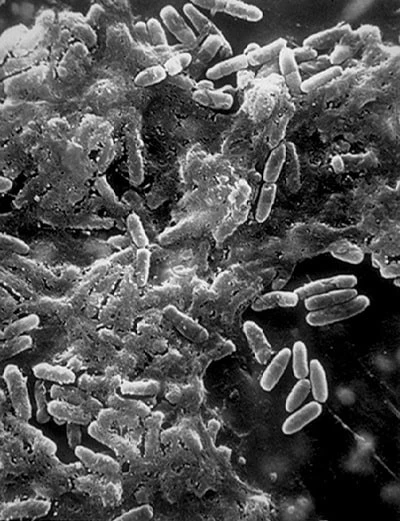 Внутрішньолікарняні інфекції: катетер-асоційовані зараження кровотоку Внутрішньолікарняні інфекції: катетер-асоційовані зараження кровотоку