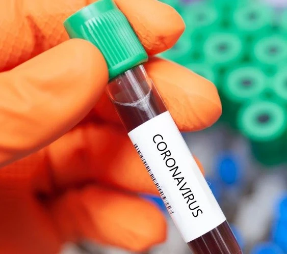 МОЗ має план дій на випадок 6000 хворих на COVID-19 за добу МОЗ має план дій на випадок 6000 хворих на COVID-19 за добу