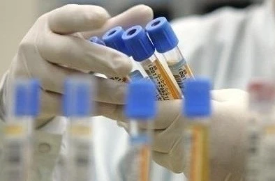 Приватні лабораторії отримають 100 млн грн для тестування на COVID-19 Приватні лабораторії отримають 100 млн грн для тестування на COVID-19