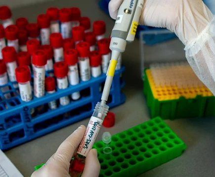 До кінця року кількість ПЛР-тестувань в Україні збільшать майже вдвічі До кінця року кількість ПЛР-тестувань в Україні збільшать майже вдвічі