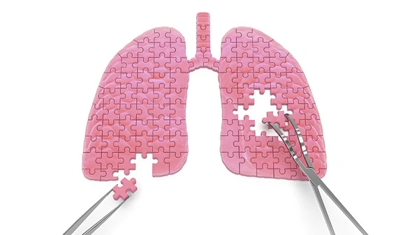 НСЗУ планує створити новий пакет медичних послуг для первинки НСЗУ планує створити новий пакет медичних послуг для первинки