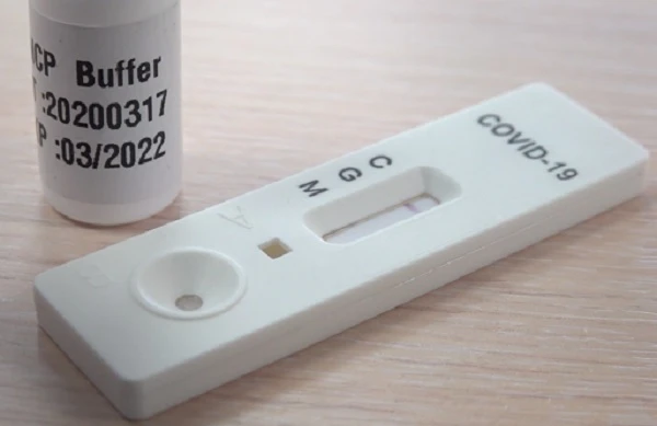 Центри ПМД можуть створювати мобільні бригади та пункти тестування на COVID-19, — НСЗУ Центри ПМД можуть створювати мобільні бригади та пункти тестування на COVID-19, — НСЗУ