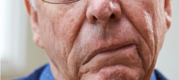 НСЗУ назвала нові вимоги до стаціонарної допомоги пацієнтам з гострим мозковим інсультом НСЗУ назвала нові вимоги до стаціонарної допомоги пацієнтам з гострим мозковим інсультом