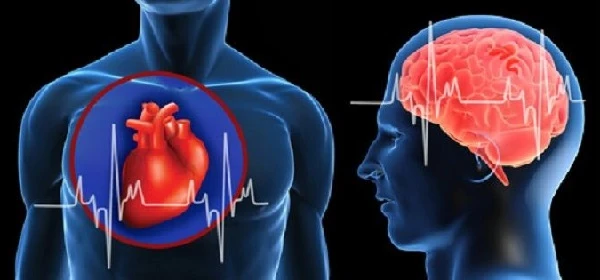 Експерти НСЗУ обговорили умови закупівлі послуг за напрямами меддопомоги під час інфарктів та інсультів Ляшко уточнив, які заклади мають право лікувати пацієнтів з інфарктами та інсультами