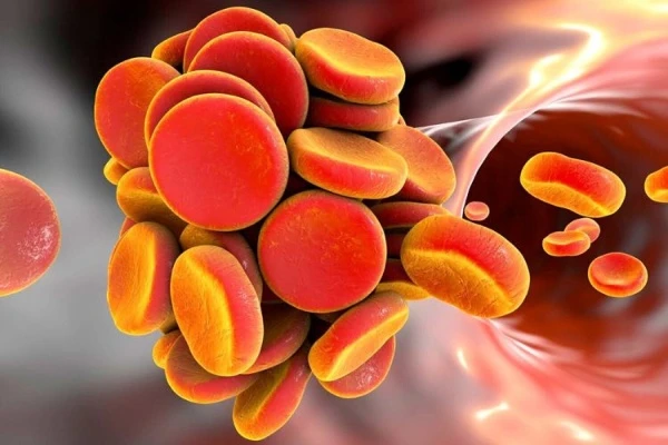 Частота образования тромбов при тяжелом и легком течении COVID-19 значительно выше, чем из-за вакцинации, – Минздрав Частота образования тромбов при тяжелом и легком течении COVID-19 значительно выше, чем из-за вакцинации, – Минздрав