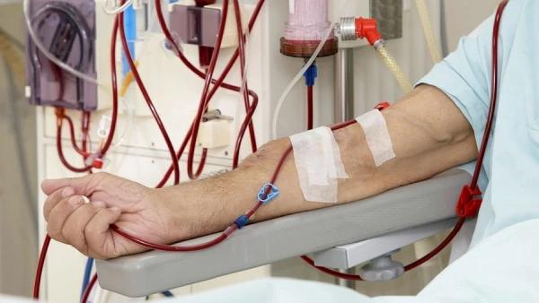 Процедури діалізу в воєнних умовах: роз’яснення МОЗ Процедури діалізу в воєнних умовах: роз’яснення МОЗ