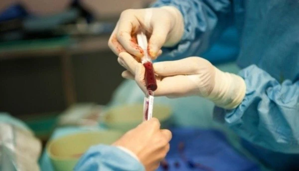 ВРУ звільнить від ПДВ операції з трансплантації анатомічних матеріалів Як пацієнту підготуватися до планової операції: роз’яснення НСЗУ